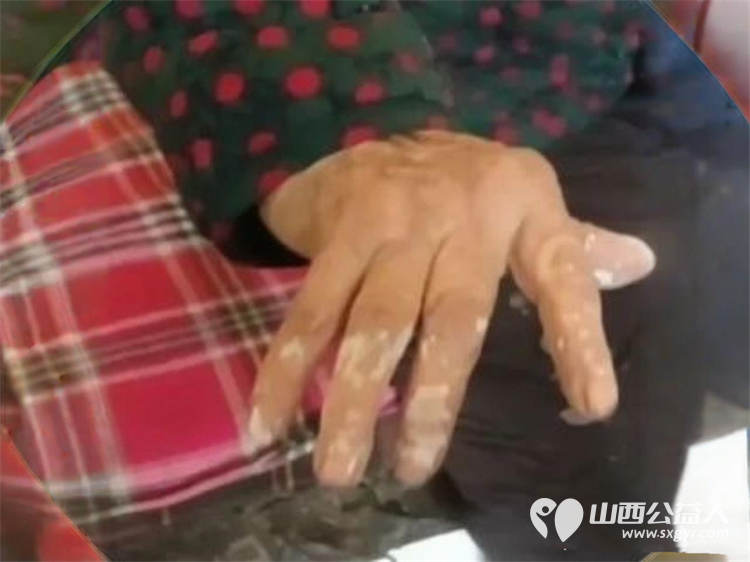 志愿暖冬情系困境老人——晋中市太谷区心连心志愿者协会志愿者带着爱心物资奔赴阳邑乡阳邑村走访看望孤寡困境老人 - 第5张